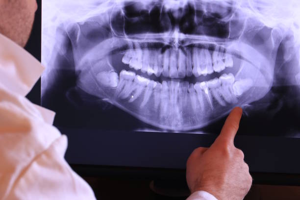 Best Tooth Pain Emergency Relief  in Forrest, IL