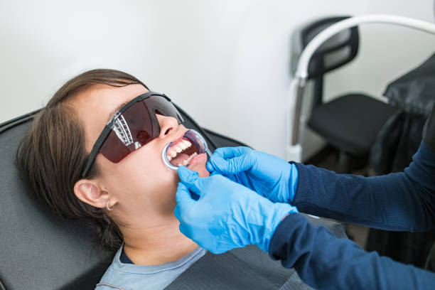 Best Teeth Whitening  in Forrest, IL